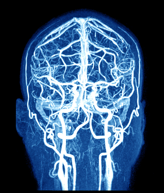MRT des Gehirns und der Gehirngefäße