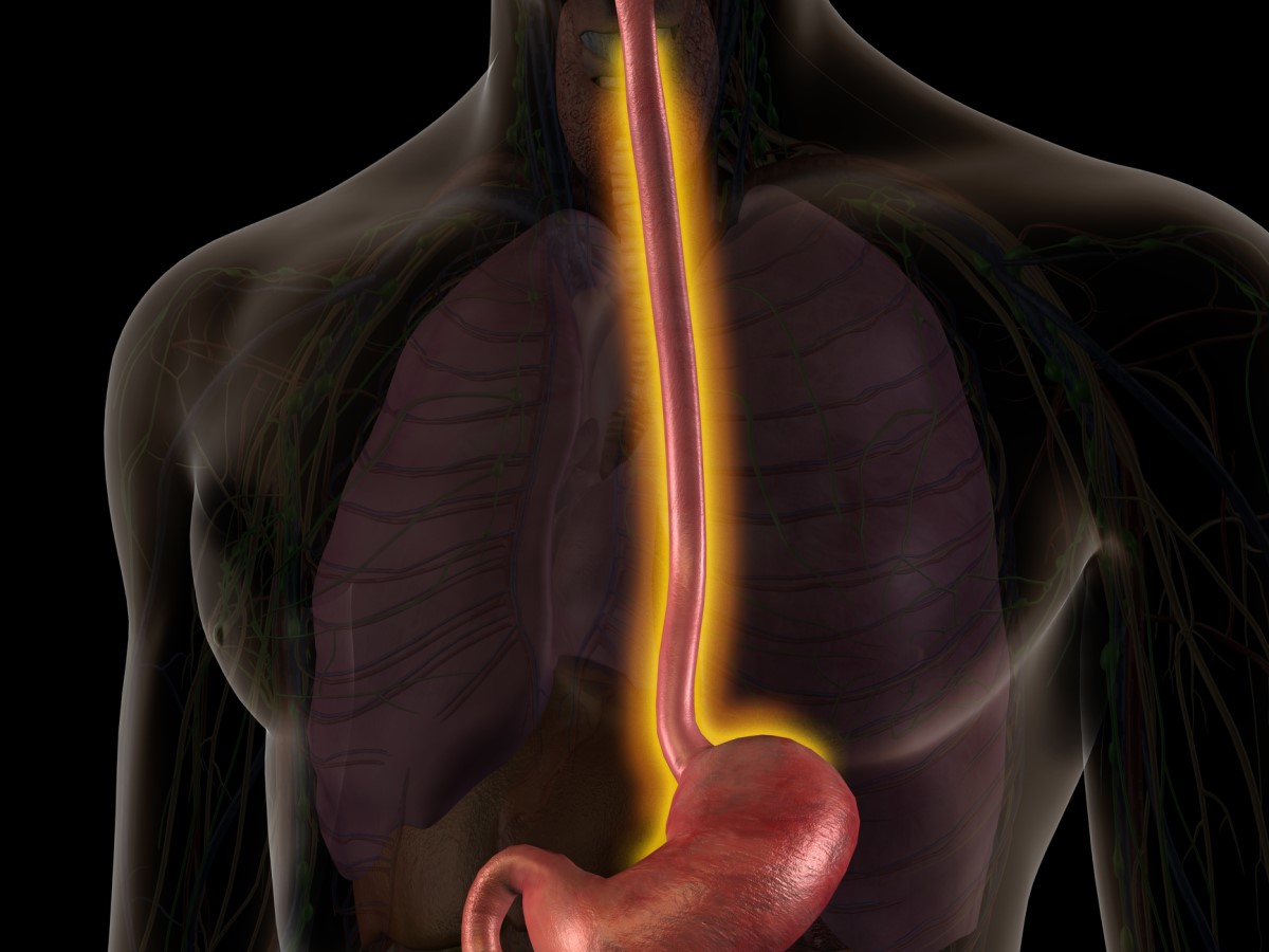 Anatomische Darstellung der Speiseröhre - die Speiseröhre ist orange hervorgehoben.