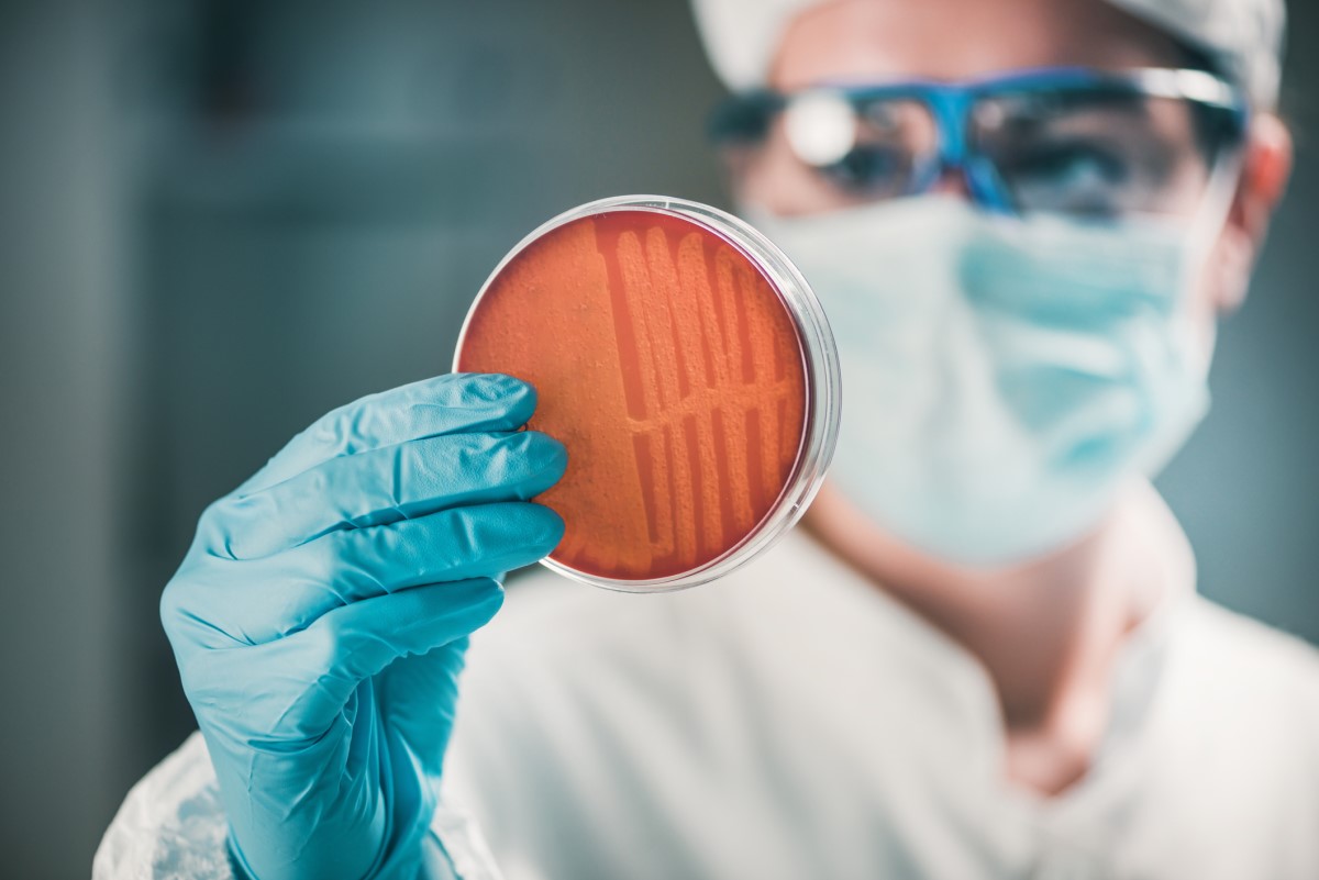 Die Kultivierung von Keuchhustenzellen ist nur im Frühstadium der Krankheit und vor Beginn einer Antibiotikabehandlung sinnvoll. Bildquelle: Getty Images