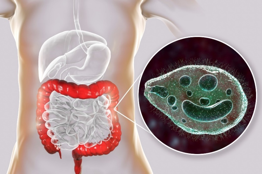 Balantidium coli - ein Parasit, der den Dickdarm des menschlichen Verdauungstrakts befällt