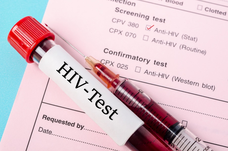 Diagnostischer Test auf das Vorhandensein von Anti-HIV-Antikörpern in einer Blutprobe eines Patienten