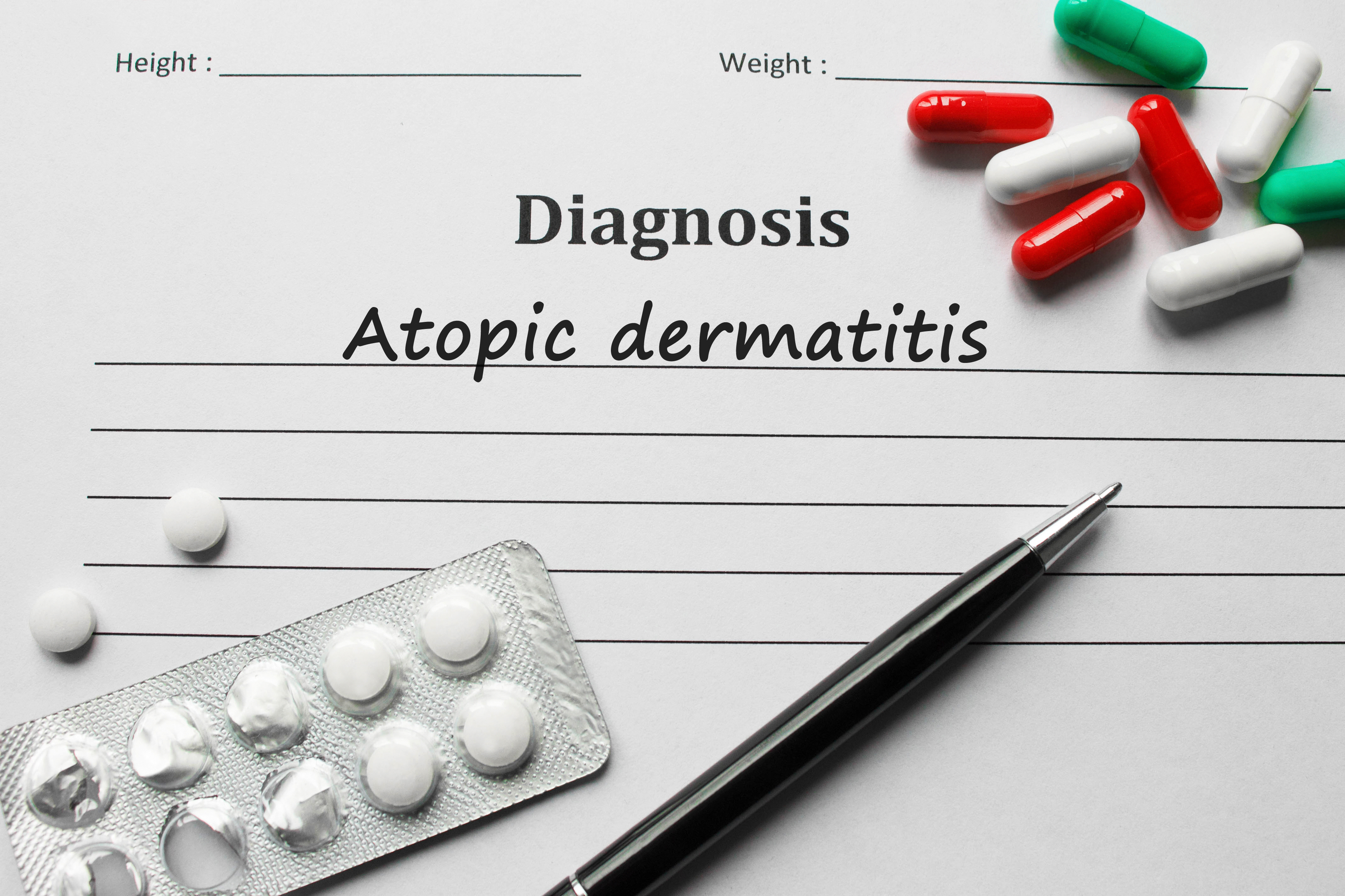 Diagnose der atopischen Dermatitis