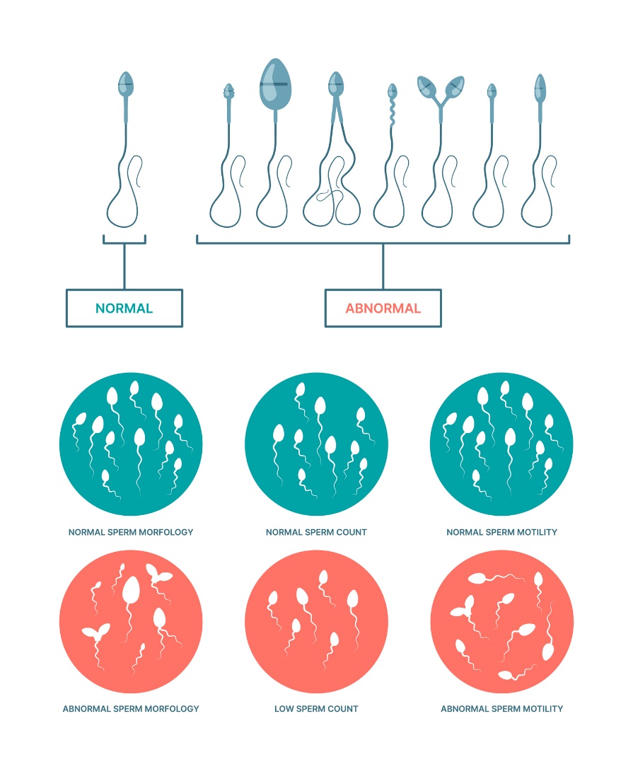 Physiologischer und abnormaler Zustand der Spermien; Morphologie, Anzahl und Beweglichkeit der Spermien