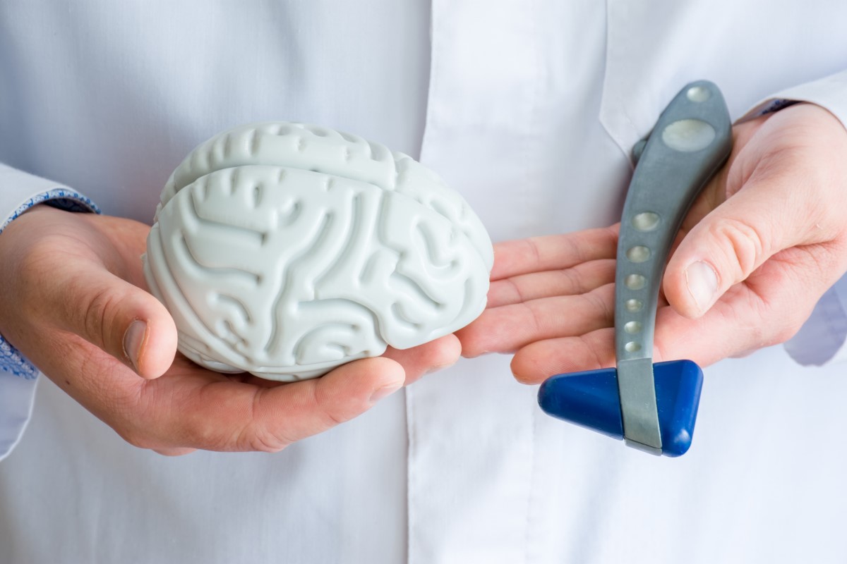 Untersuchung durch einen Neurologen, der Arzt hält ein Modell des Gehirns und eine neurologische Untersuchung mit einem Hammer.