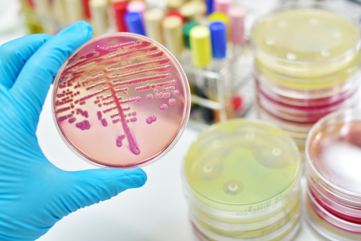 Mikrobiologische Untersuchung - Kultur - Bakterienkolonien