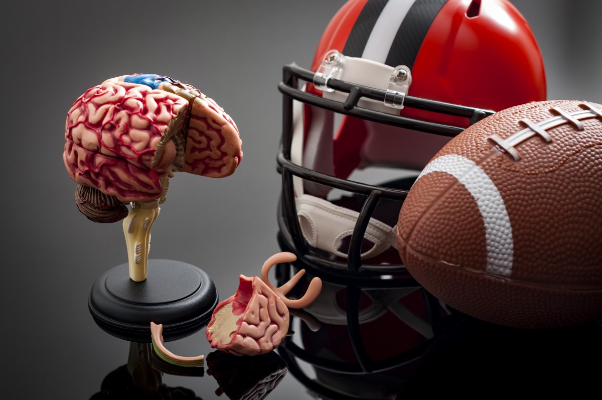 American Football als Vertreter der Sportarten mit wiederholten Kopfverletzungen