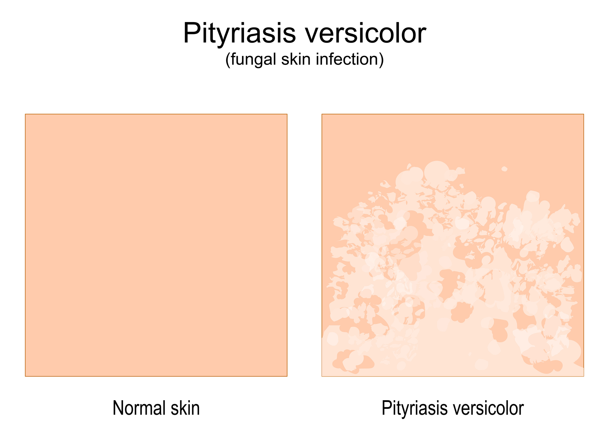 Vergleich von normaler Haut und Haut mit Krankheitsanzeichen
