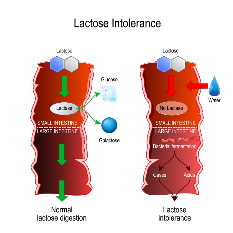 Vergleich von physiologischer Verdauung und Laktoseintoleranz