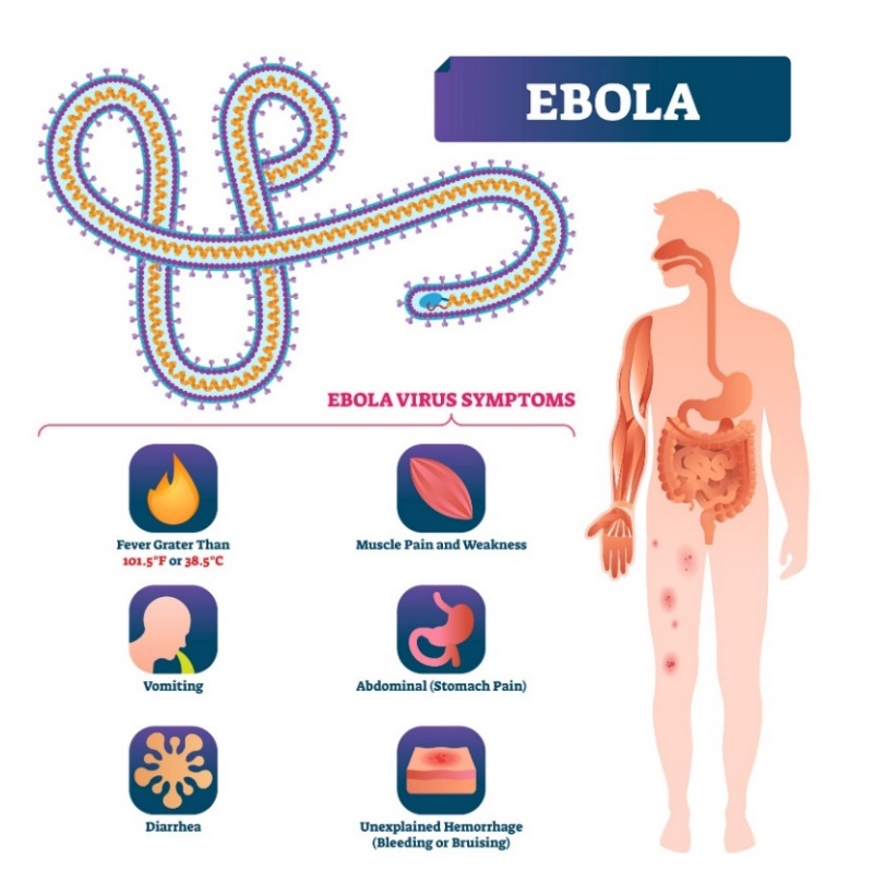 Symptome von Ebola