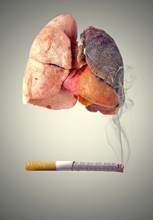 Durch Rauchen und Krebs zerstörte Lungen - symbolische Darstellung