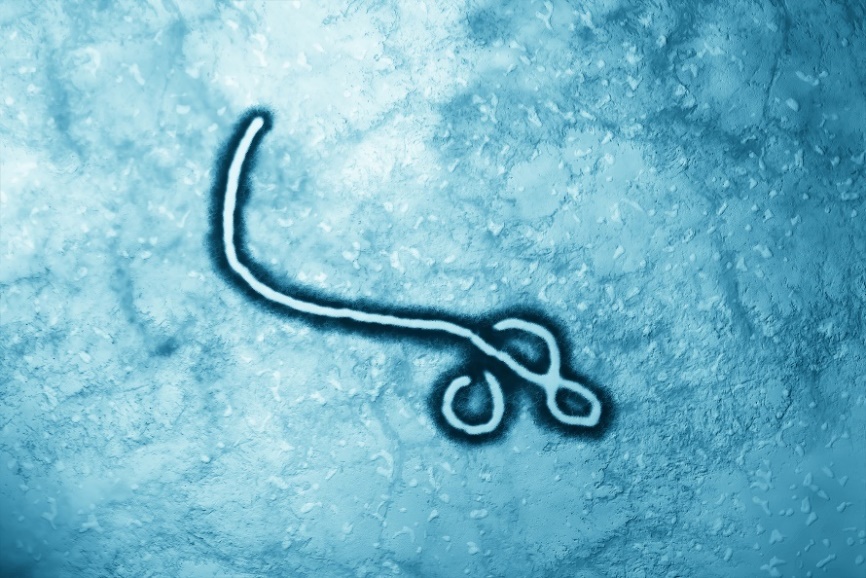 Das Ebola-Virus unter dem Mikroskop