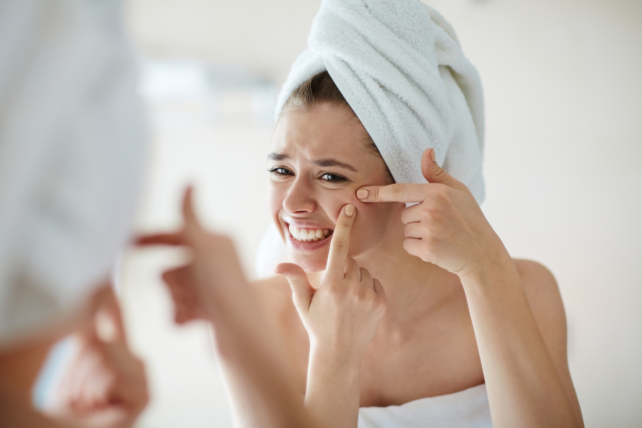 Eine Frau mit Akne im Gesicht, die ihre Pickel auspresst, hat ein Handtuch im Haar.