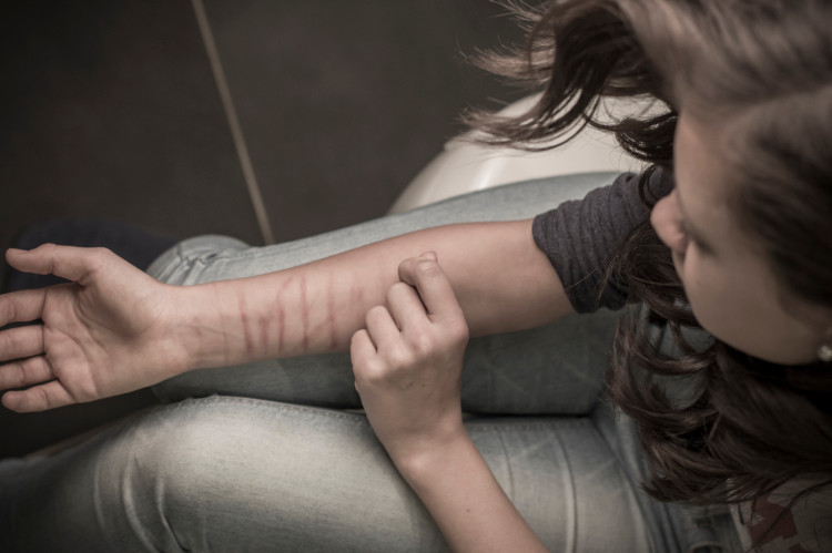 eine junge Frau schneidet sich mit einem scharfen Gegenstand in den Unterarm