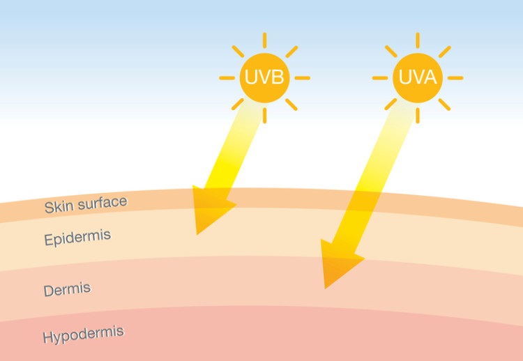 ultraviolette Strahlung, die in die Haut eindringt, schematische Darstellung
