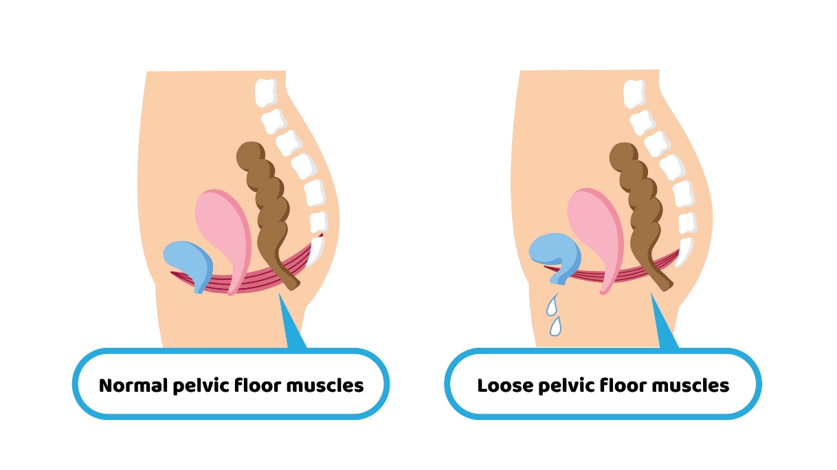 Physiologie der Beckenbodenmuskulatur und Beckenbodenmuskelschwäche