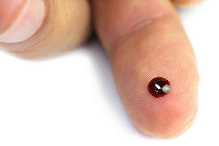 Glykämie - ein Blutstropfen am Bauch des Fingers nach einem Nadelstich zur Messung des Blutzuckers