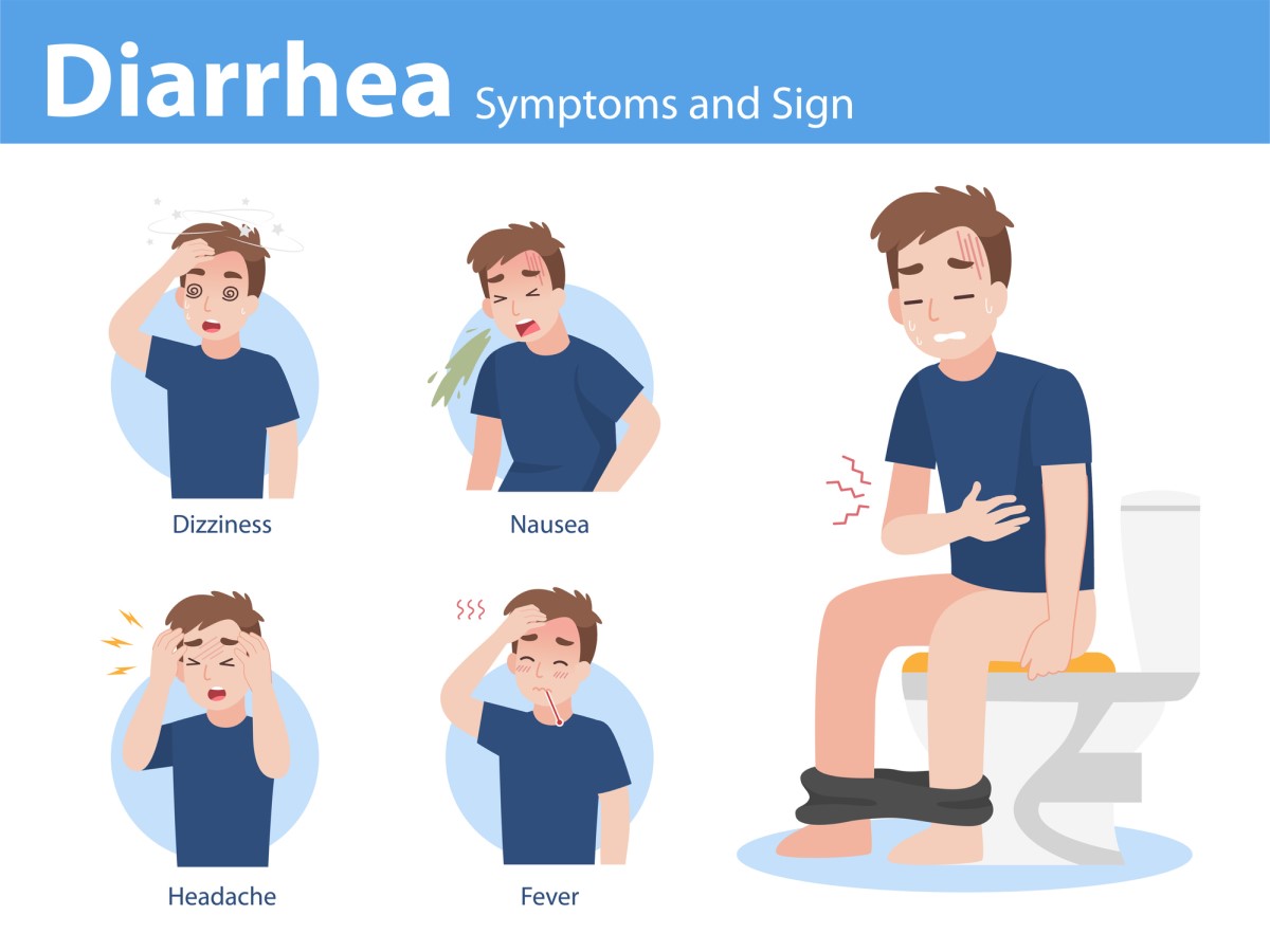 Durchfall (Diarrhöe) und mögliche Begleitsymptome: Schwindel (Übelkeit, Schwindel), Übelkeit (Erbrechen), Kopfschmerzen, Fieber (erhöhte Körpertemperatur), Krämpfe und Bauchschmerzen