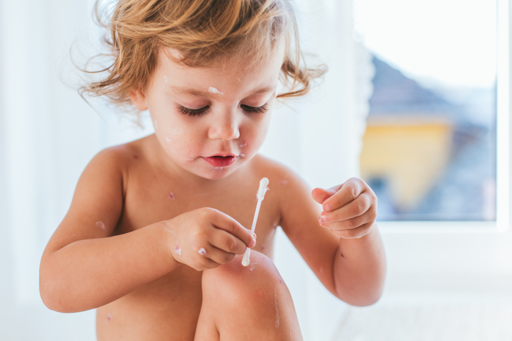 Ein nacktes Kind behandelt seine Haut mit einem Wattestäbchen