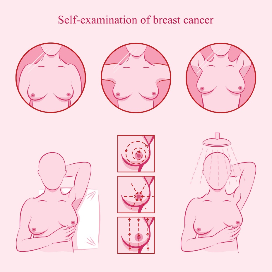 Illustration der Selbstuntersuchung der Brust
