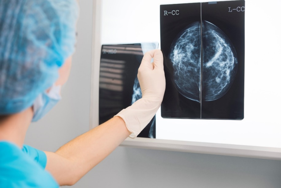 Mammographie der Brust