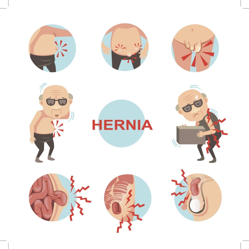 Hernie - Modell der Symptome