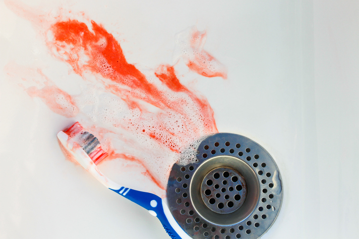 Zahnfleischbluten, Waschbecken, Blut, Zahnpasta, Zahnbürste, unsachgemäße Mundhygiene, unsachgemäßes Putzen