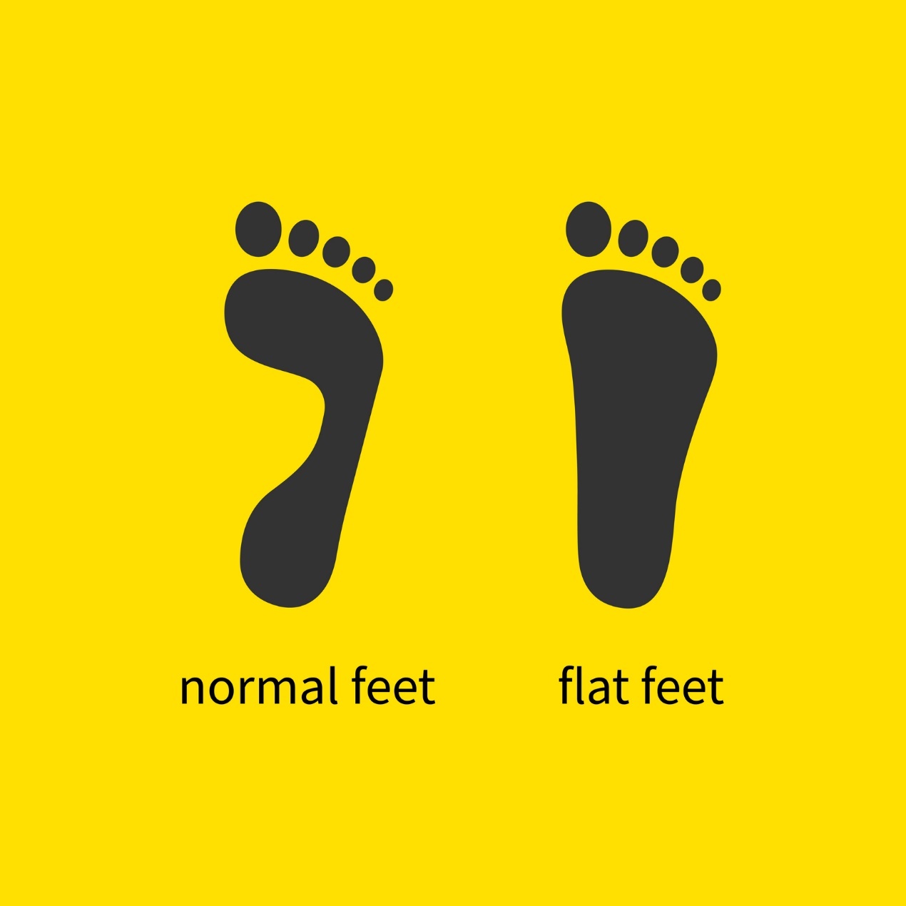 Unterschied zwischen Plattfuß und normalem Fuß