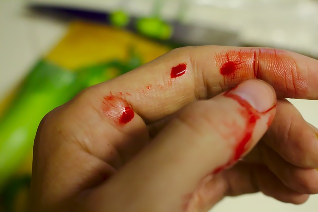 Hand, Blut, Blutung, Verletzung