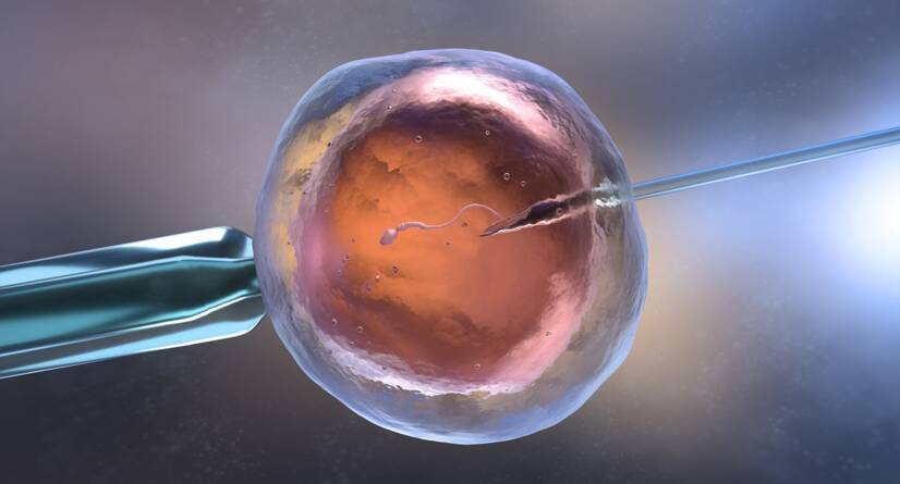 In-vitro-Fertilisation IVF, Quelle: Getty Images