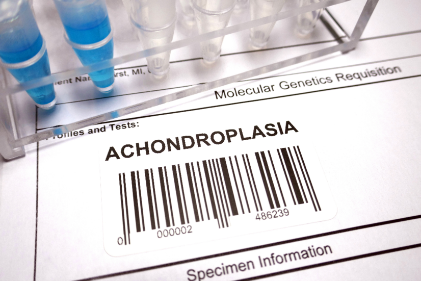 Achondroplasie: Was sind die Ursachen und Symptome der angeborenen Knochenerkrankung?