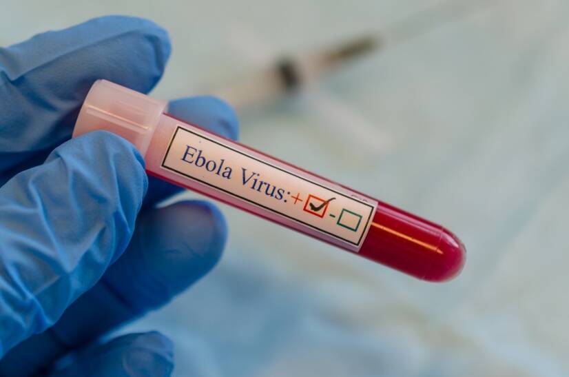 Ebola: Was sind die Symptome?