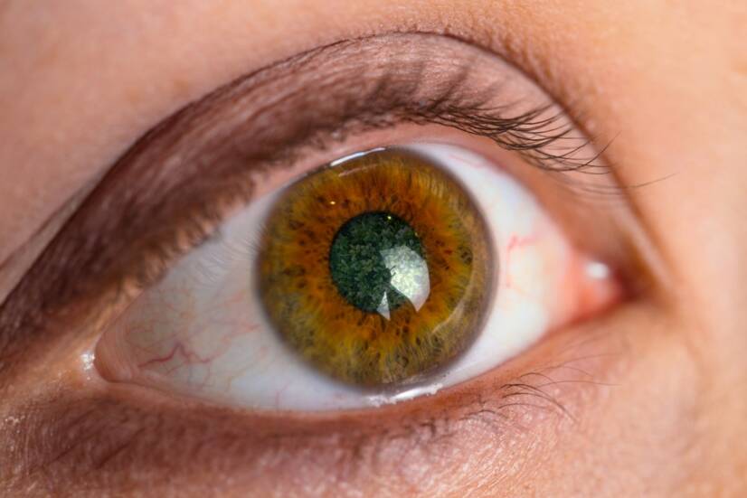 Glaukom - Grüner Star: Was sind seine Ursachen, Symptome und Behandlung?