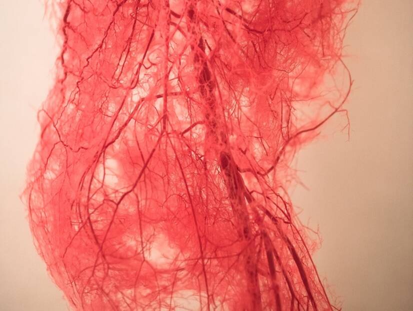 Periphere arterielle Verschlusskrankheit: Was sind die Ursachen und Symptome? + Prävention und Behandlung