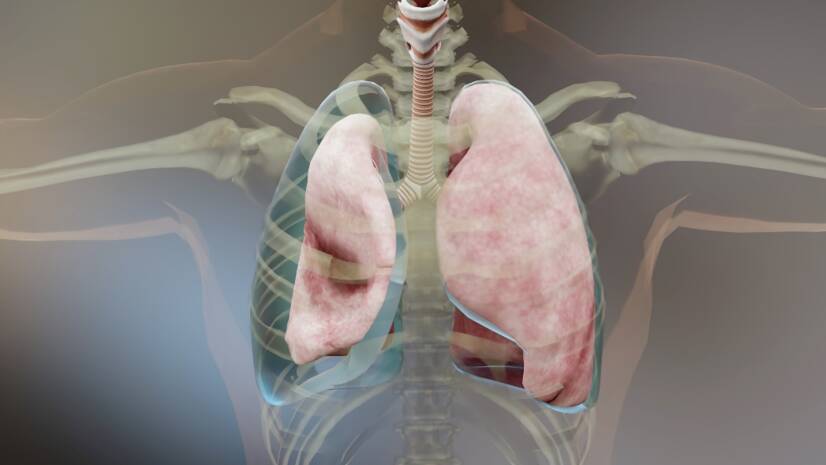 Pneumothorax (Luft in der Brust): Ursachen, Symptome und Erste Hilfe
