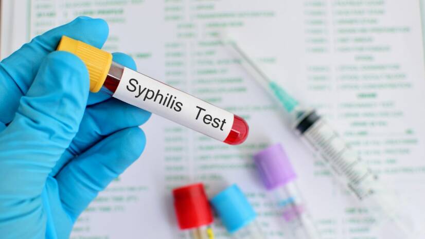 Syphilis: Was sind die Symptome, die Stadien, die bleibenden Folgen? Wie wird sie übertragen?