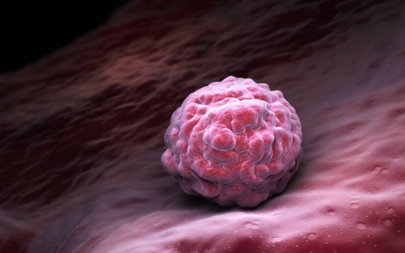 Einnistung des Embryos in die Gebärmutterschleimhaut, Fotoquelle: Getty Images