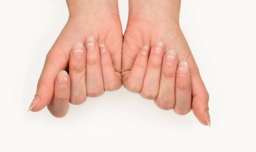 Weiße Flecken auf den Nägeln: Was bedeuten sie und was sind die Ursachen?