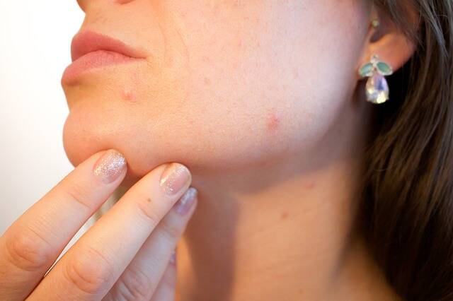Hautausschlag: Was sind die Ursachen für Hautausschläge (auch für entzündete, rote und juckende Ausschläge)?