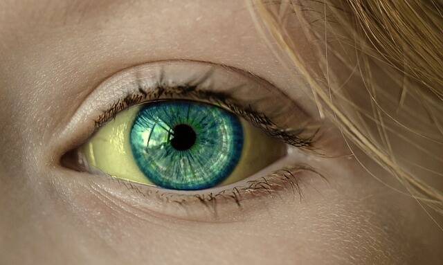 Was kann ein gelbes Augenweiß verursachen?