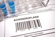 Achondroplasie: Was sind die Ursachen und Symptome der angeborenen Knochenerkrankung?