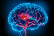 Blutungen im Gehirn: Warum treten sie auf und was sind ihre Symptome?