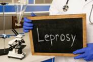 Lepra: Was ist Lepra, wie entsteht sie und was sind ihre Symptome?