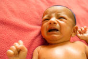 Wann ist Neugeborenengelbsucht gefährlich? Was ist das und warum tritt Gelbsucht bei Neugeborenen auf?