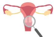 Gebärmutterhalskrebs: Ursachen und Symptome, Prävention