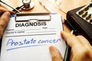 Prostatakrebs: Ursachen, Symptome, Prognosen und Behandlung
