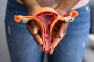 Was ist eine Zervixkonisation und wie wird sie durchgeführt? Genesung und Schwangerschaft