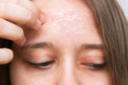 Was ist ein Peeling und wie hilft es der Haut von Gesicht und Körper? + Arten und hausgemachte Variante