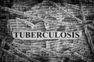 Die Tuberkulose gehört nicht der Vergangenheit an, sie tötet jedes Jahr Millionen von Menschen