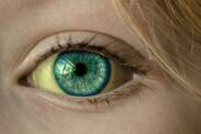 Was kann ein gelbes Augenweiß verursachen?