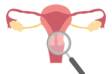 Gebärmutterhalskrebs: Ursachen und Symptome, Prävention